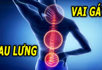 thuong-xuyen-dau-lung-dau-moi-vai-gay-te-bi-chan-tay-cho-nen-chu-quan