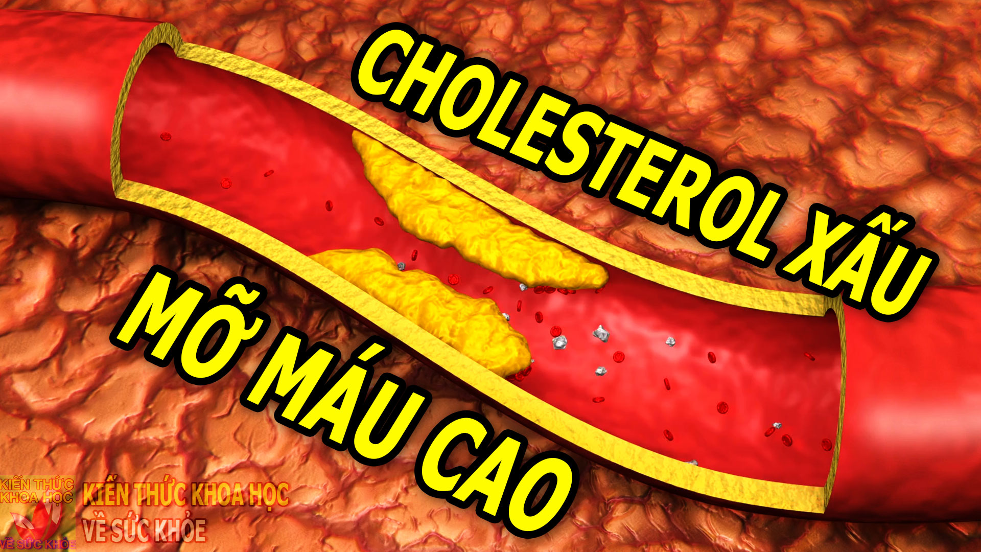 cach-lam-giam-cholesterol-xau-trong-mau