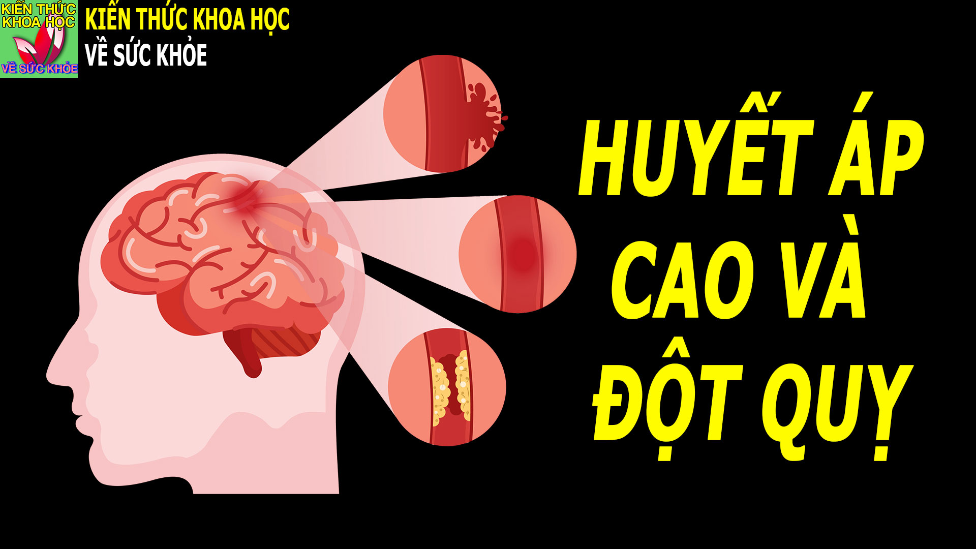 tai-sao-tang-huyet-ap-de-gay-dot-quy