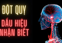 dau-hieu-canh-bao-dot-quy-ai-cung-can-biet-som