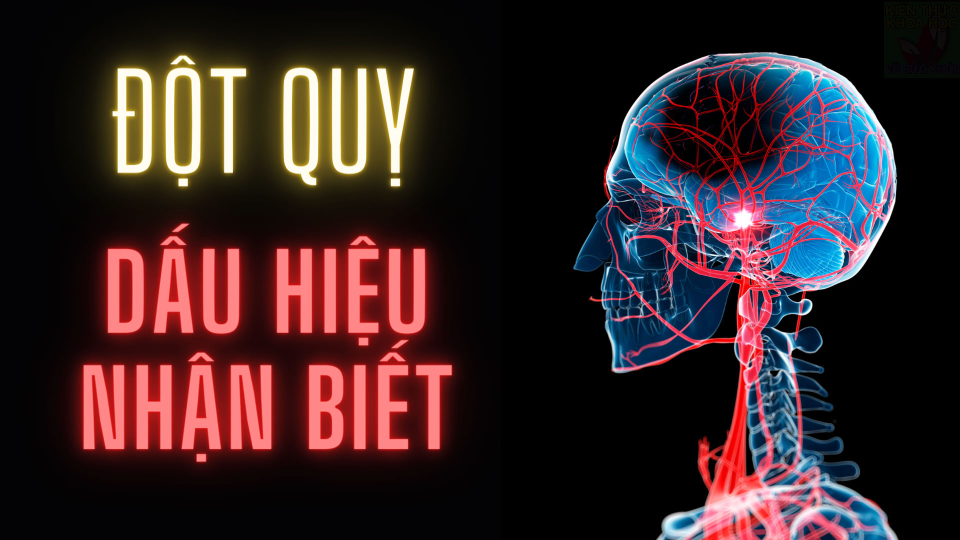 dau-hieu-canh-bao-dot-quy-ai-cung-can-biet-som