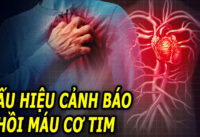 dau-hieu-canh-bao-mot-nguoi-sap-bi-nhoi-mau-co-tim