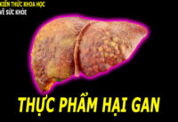 7-loai-thuc-pham-am-tham-hai-gan