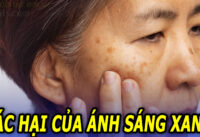 tac-hai-cua-anh-sang-xanh-doi-voi-lan-dan