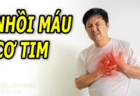 3-thoi-quen-lam-tang-nguy-co-bi-nhoi-mau-co-tim