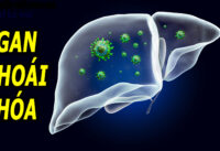 thoi-quen-nhieu-nguoi-mac-phai-khien-gan-bi-thoai-hoa