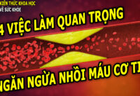4-viec-lam-quan-trong-giup-ngan-ngua-nhoi-mau-co-tim