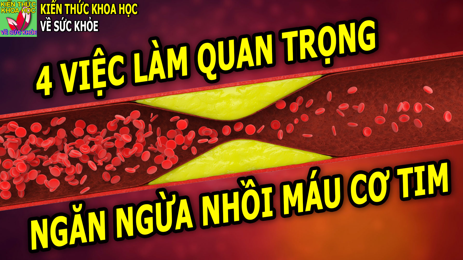 4-viec-lam-quan-trong-giup-ngan-ngua-nhoi-mau-co-tim