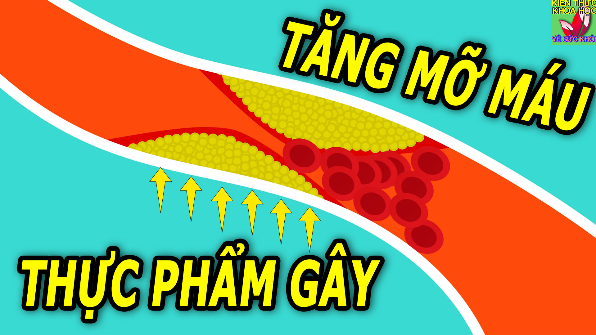 5-loai-thuc-pham-gay-tang-mo-mau