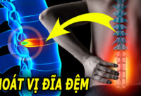 5-nguyen-nhan-gay-thoat-vi-dia-dem-hang-dau-ai-cung-nen-biet-som