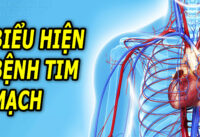 bieu-hien-cua-benh-tim-mach-giai-doan-dau