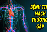 cac-benh-tim-mach-thuong-gap-o-nguoi-cao-tuoi