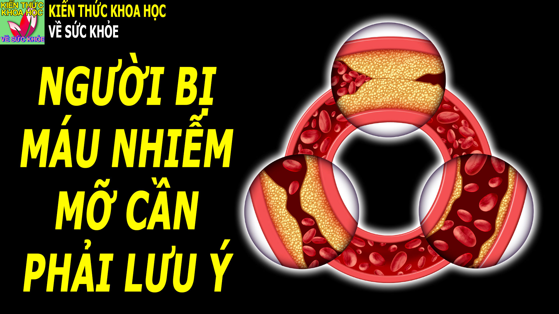 mo-mau-cao-kieng-an-uong-gi