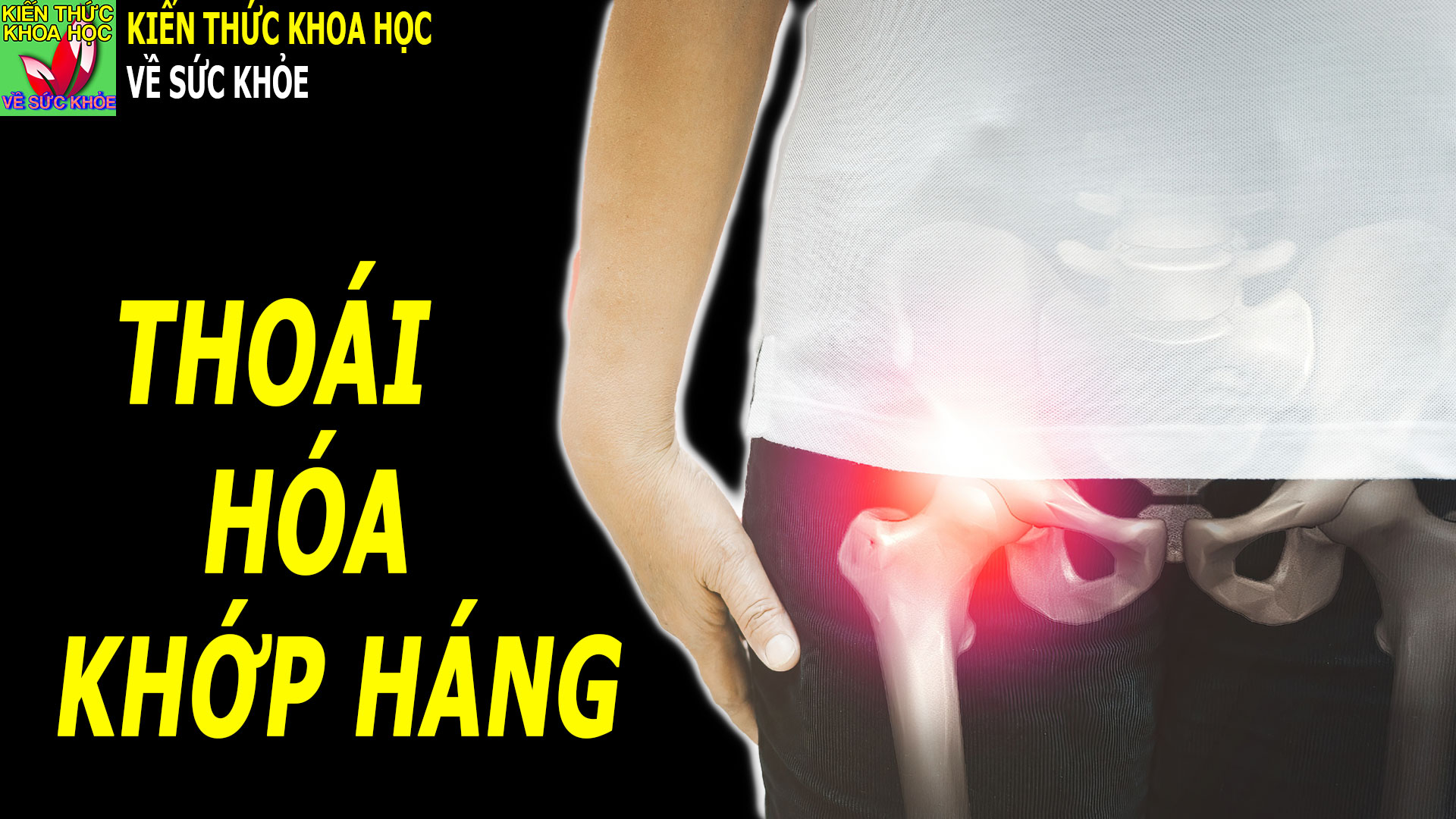 thoai-hoa-khop-hang-co-trieu-chung-gi