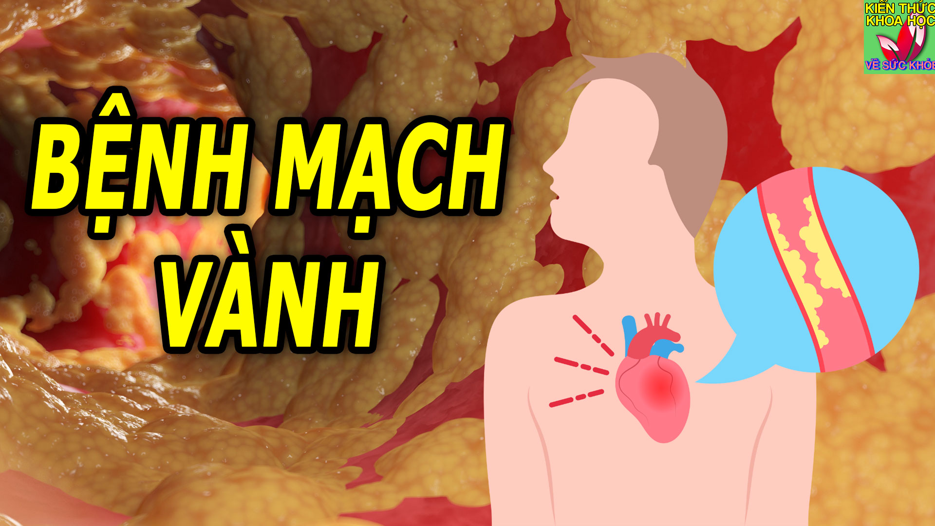 benh-mach-vanh-co-chua-khoi-duoc-khong