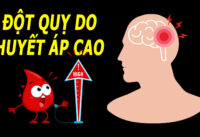 phong-ngua-dot-quy-do-huyet-ap-cao