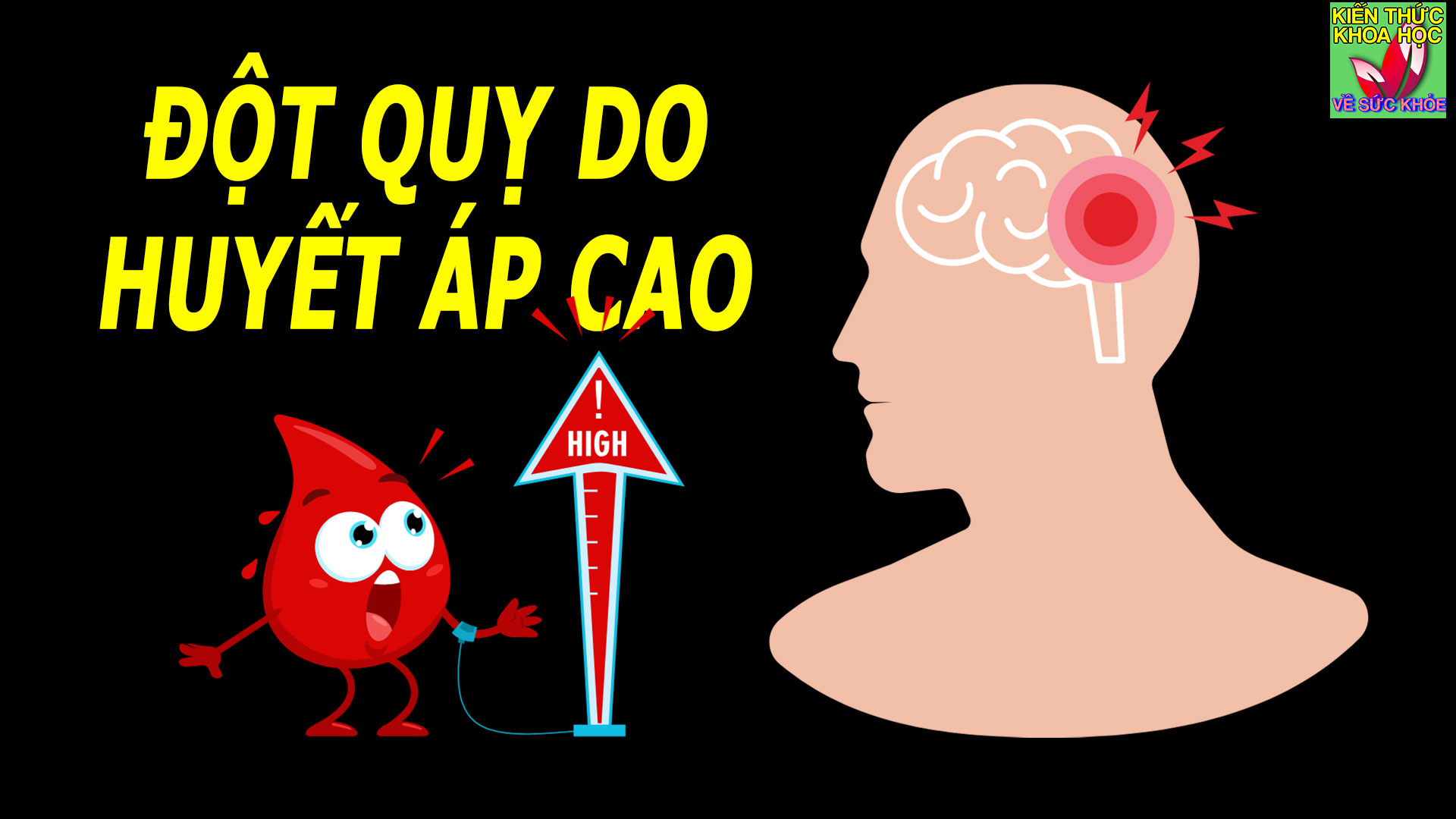 phong-ngua-dot-quy-do-huyet-ap-cao