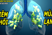 viem-phoi-mua-lanh-va-cach-phong-ngua