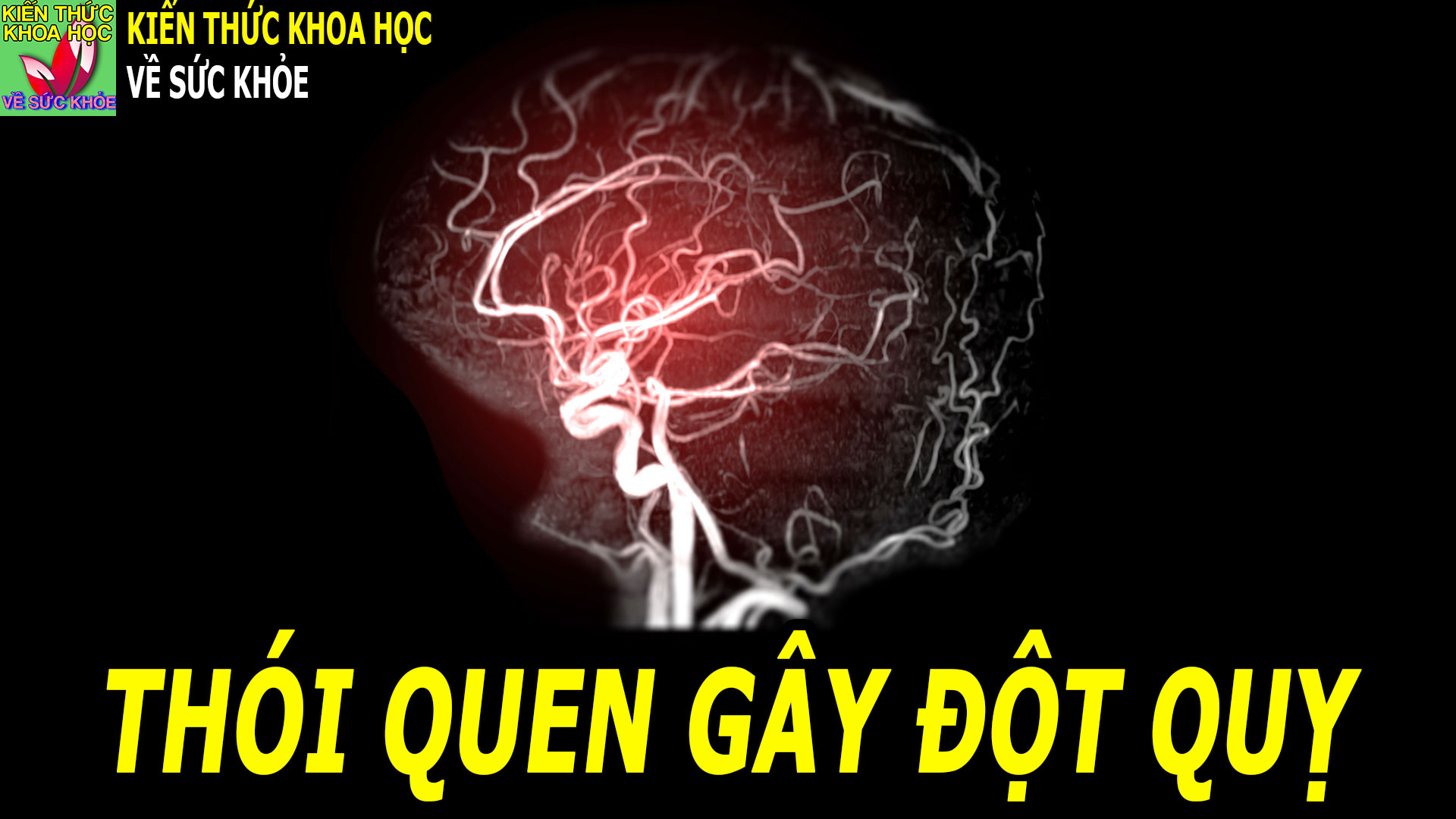 3-thoi-quen-xau-gay-ra-dot-quy