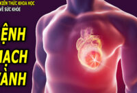 dau-hieu-benh-mach-vanh