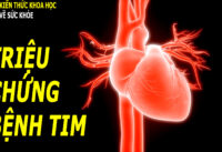 trieu-chung-cua-nguoi-bi-benh-tim-ai-cung-nen-biet-som