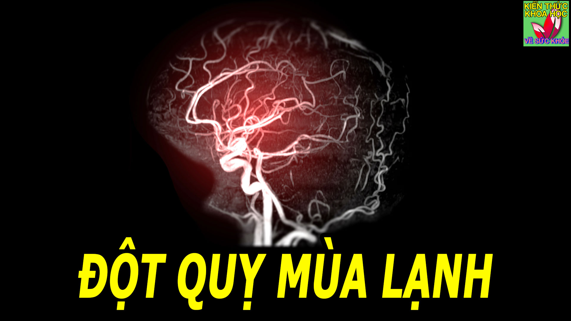 tai-sao-troi-lanh-de-bi-dot-quy