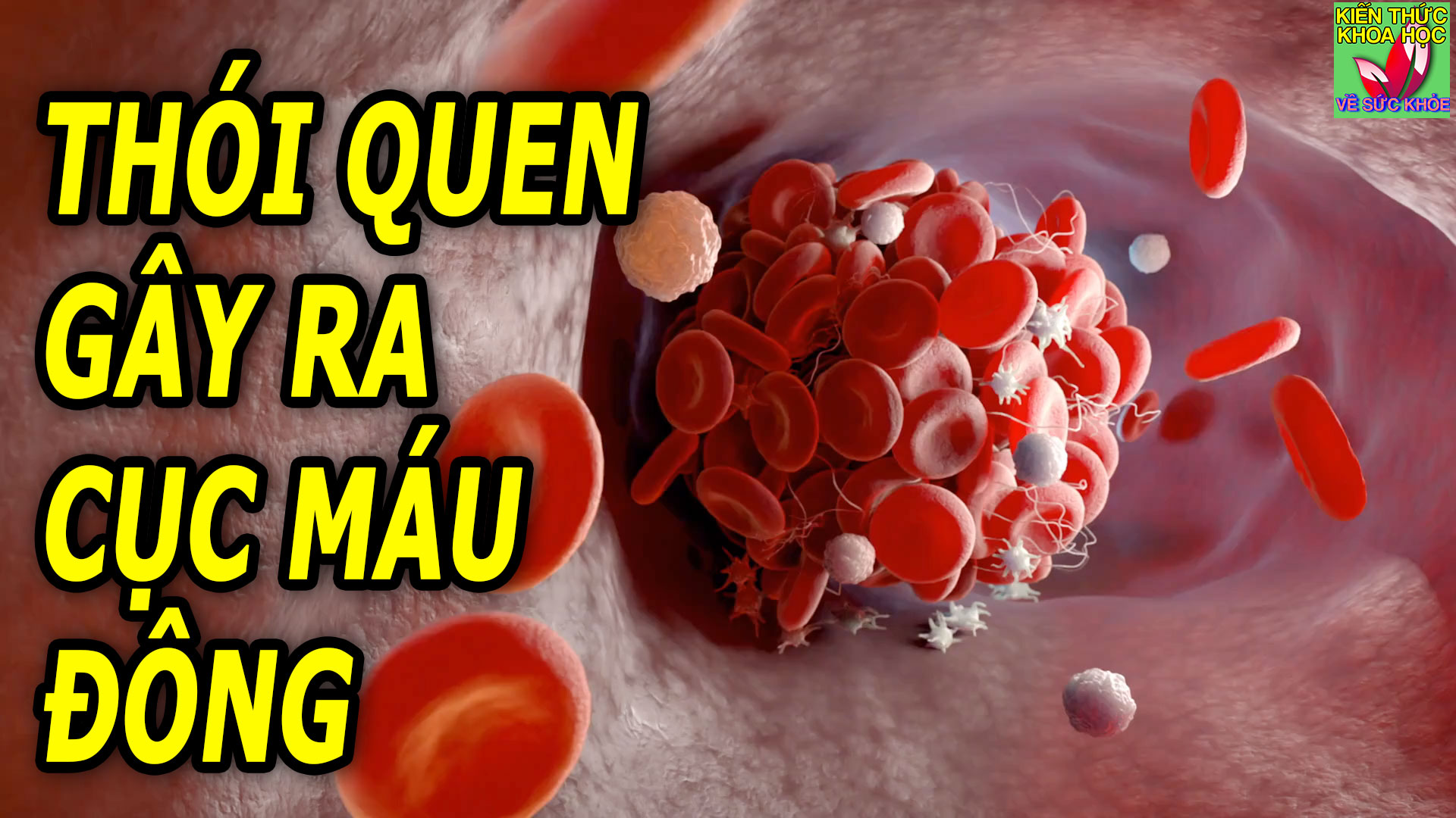 thoi-quen-pho-bien-de-gay-ra-cuc-mau-dong